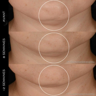 Lancome Rénergie H.P.N. 300-Peptide Crème Anti-Âge Haute-Performance 6 Lancome Rénergie H.P.N. 300-Peptide Crème Anti-Âge Haute-Performance – Image 4